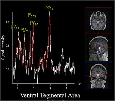 Magnetic Resonance Spectroscopy in the Ventral Tegmental Area Distinguishes Responders to Suvorexant Prior to Treatment: A 4-Week Prospective Cohort Study